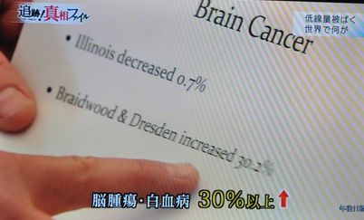 ＮＨＫ真相：脳腫瘍・白血病30%以上増加